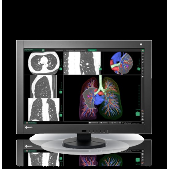 Monitor 24 inch Eizo RadiForce RX240 IPS, DP, DVI, USB, Negru